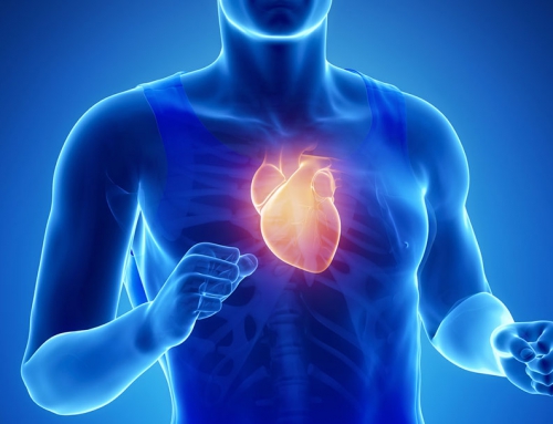 Performance Enhancement