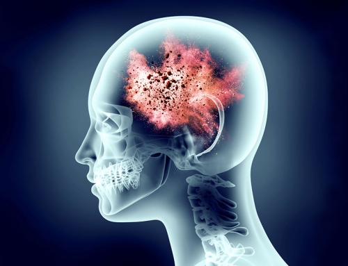 Stress & Psychological Disorders