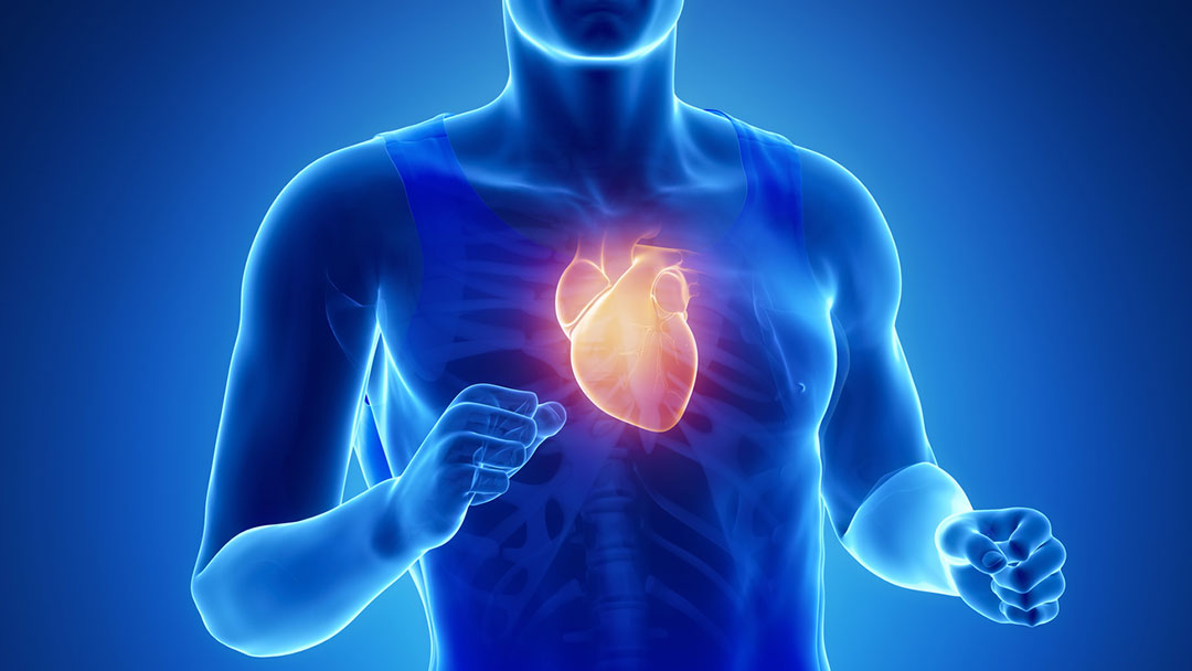 Renforcement des performances