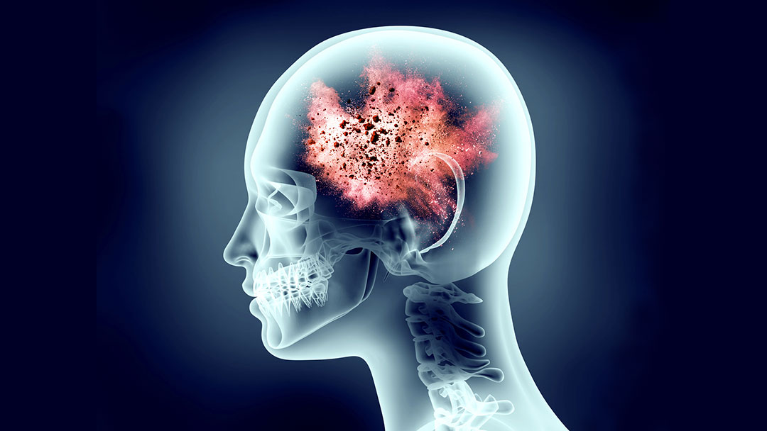 Stress & désordre psychique